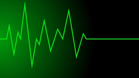 heartbeat pulse graph