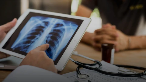 Doctor referencing chest x-ray on tablet